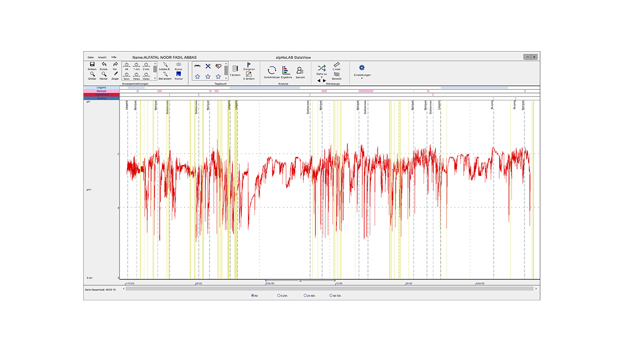 AlphaONE_Software
