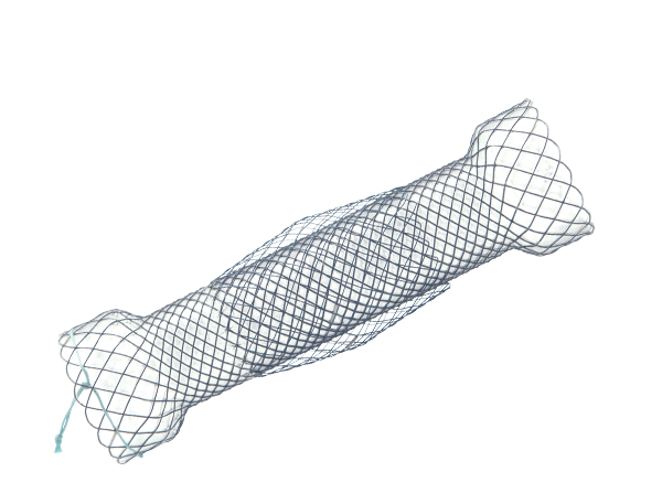 Produktebilder_Kategorie_Niti-S-Beschichteter-oesophagus-Stent-Double-Type