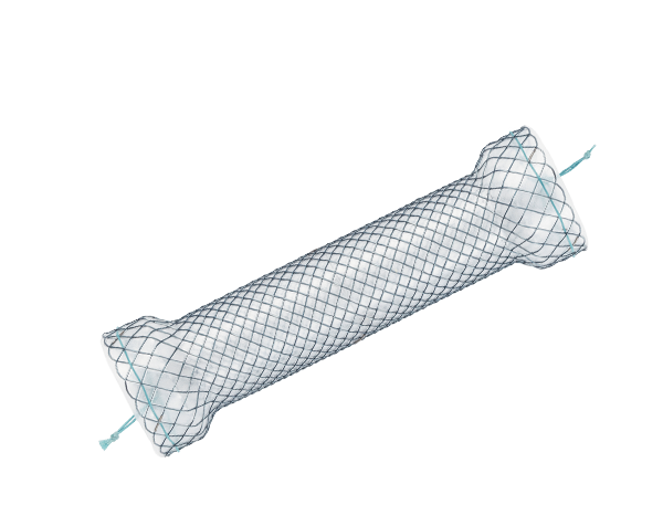 Produktebilder_Kategorie_Niti-S-Beschichteter-oesophagus-Stent-Full-Covered-Type