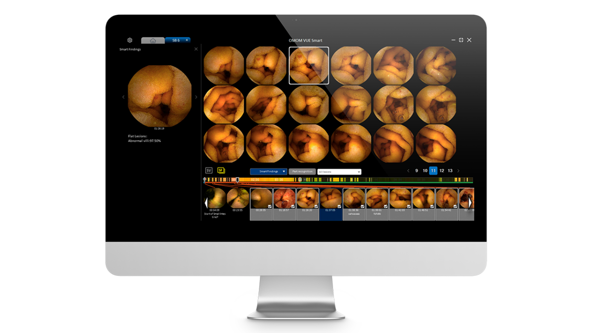 OMOM HD Capsule Endoscopy System - Admedics Advanced Medical Solutions AG
